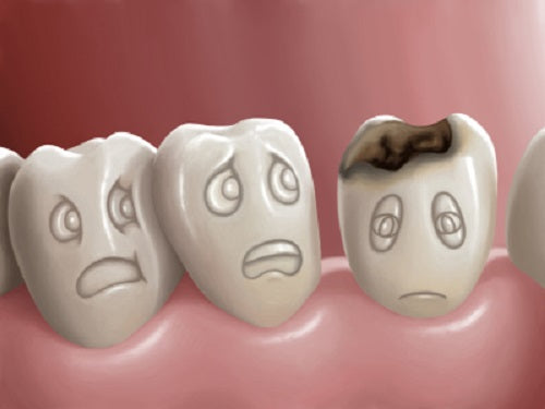 Tooth Loss Linked To Anxiety And Depression