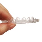 How to Align Teeth Minus The Metal And Wire Braces For A Perfect Smile