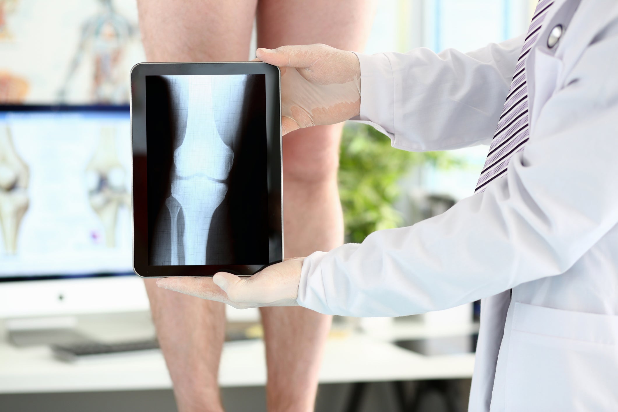 How To Handle 5 Common Causes Of Age-Related Leg Pain