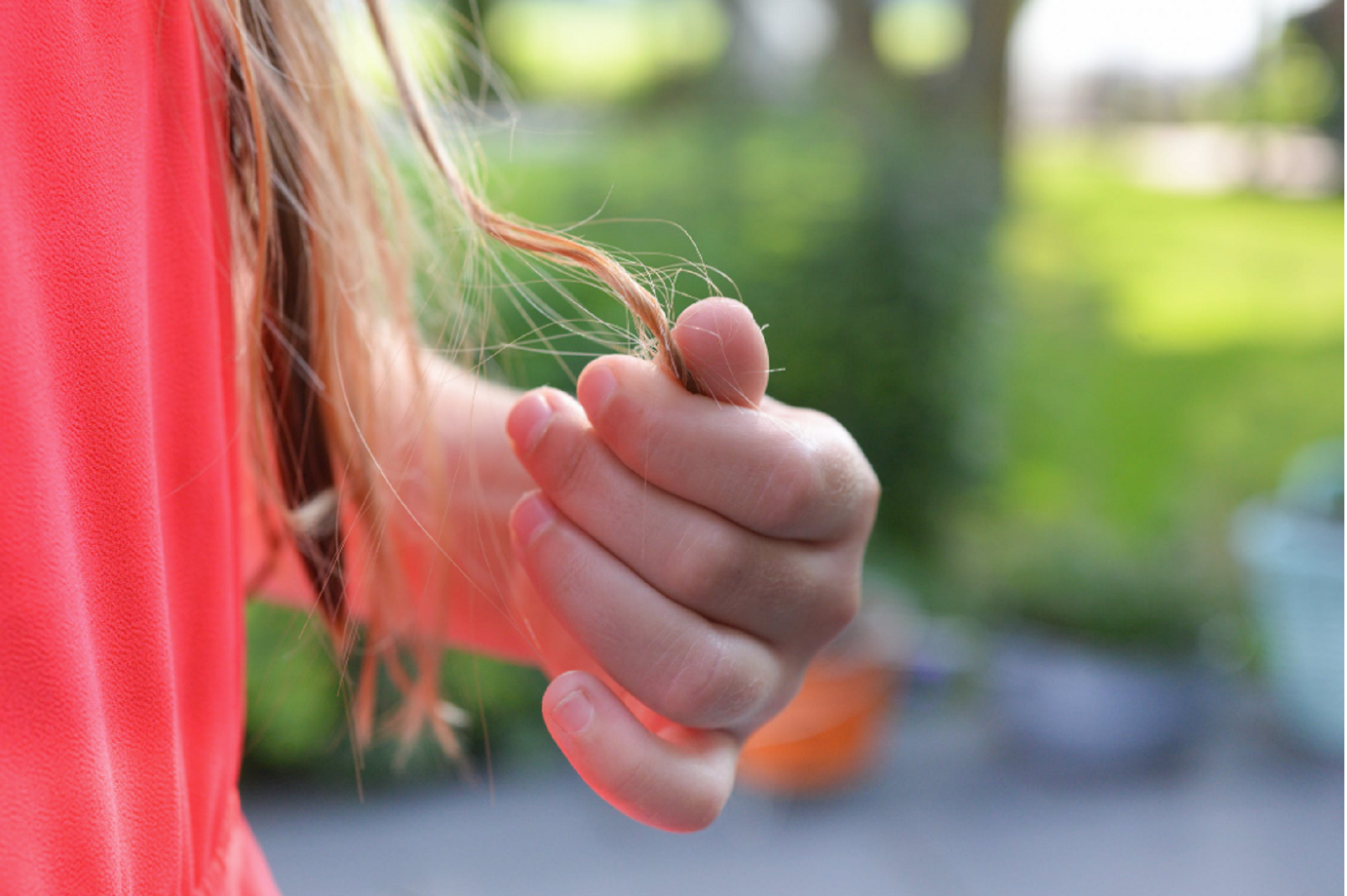 girl losing hair considering treatments