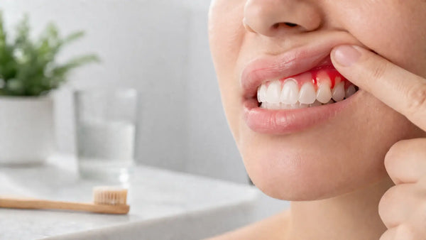 How to Stop Bleeding Gums: Causes, Remedies, & Prevention Tips