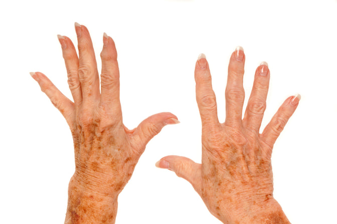 old woman hands with age spots