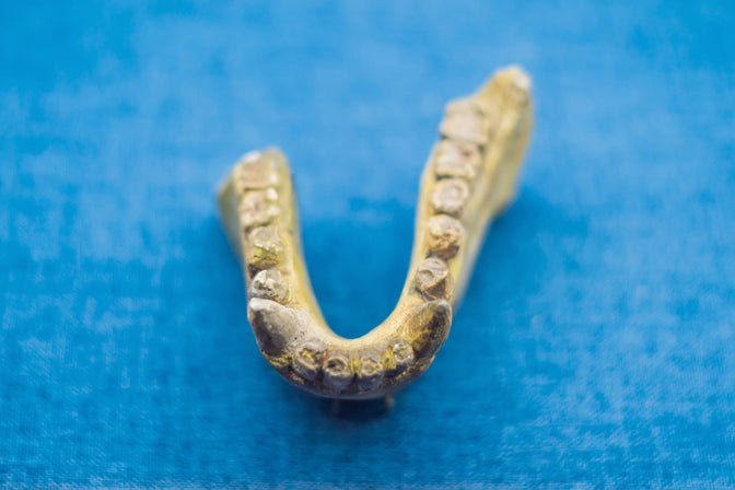 ancient teeth