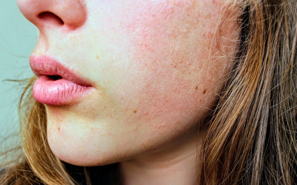 7 Ways Bentonite Clay Benefits Your Skin