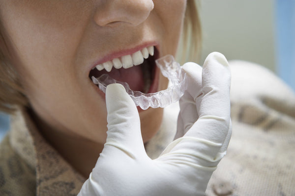 5 Different Types Of Braces And Which Is Right For You