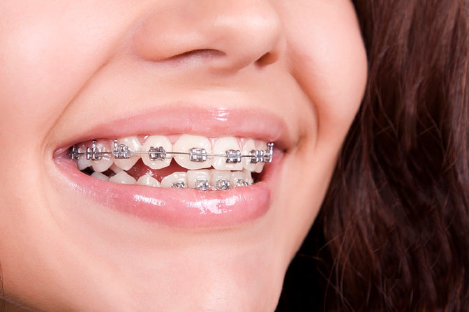 smiling girl with braces