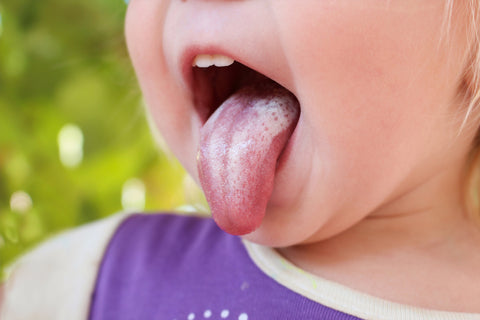 Oral Thrush Symptoms