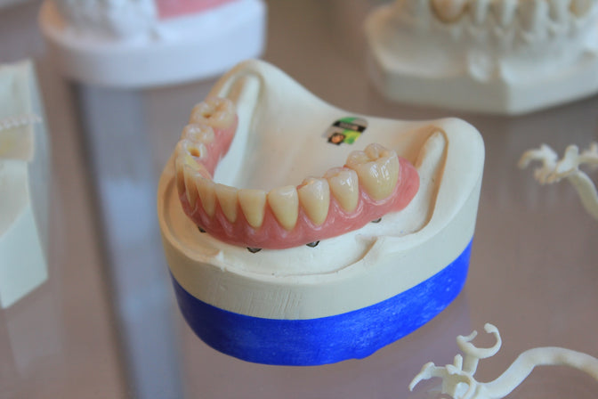 model of gums and teeth