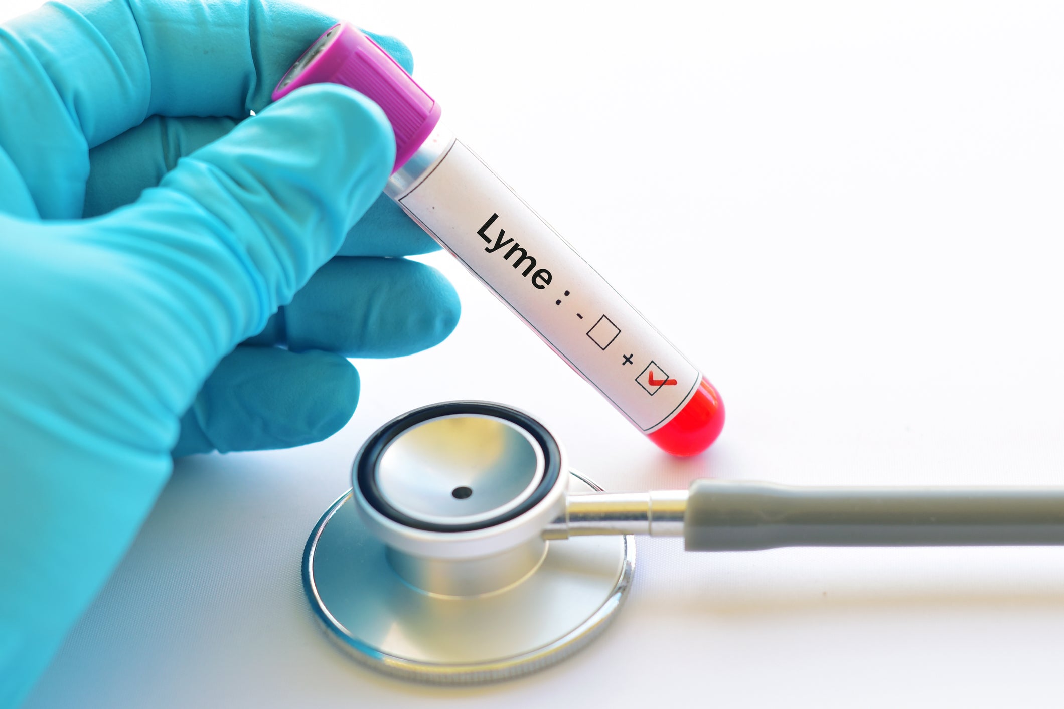 Lyme Disease News: Study Finds Multiple Agents Of Tick-Borne Diseases