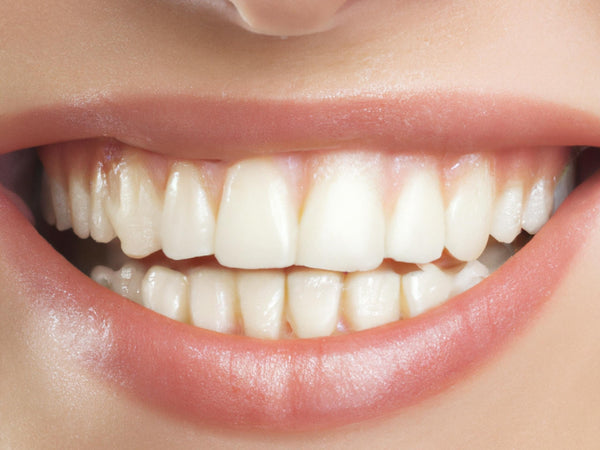 Whitening Toothpaste for Sensitive Teeth: Protecting Your Smile During Whitening Treatments