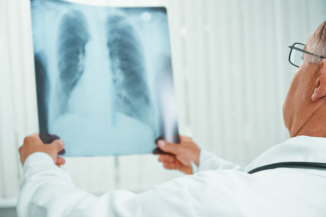 doctor looking at lung X-ray