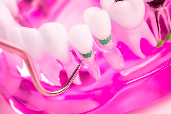 How To Eliminate Pain Tied To Tooth Decay