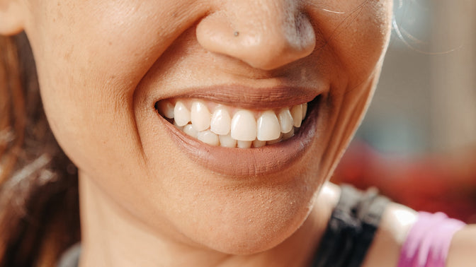 woman smiling with white teeth