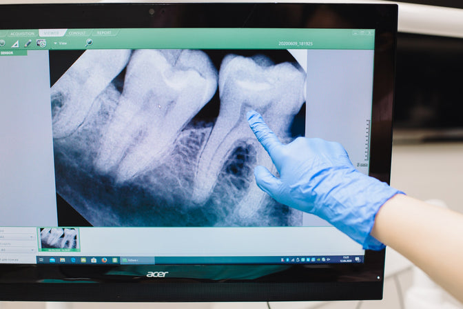 dentist looking at tooth X-ray