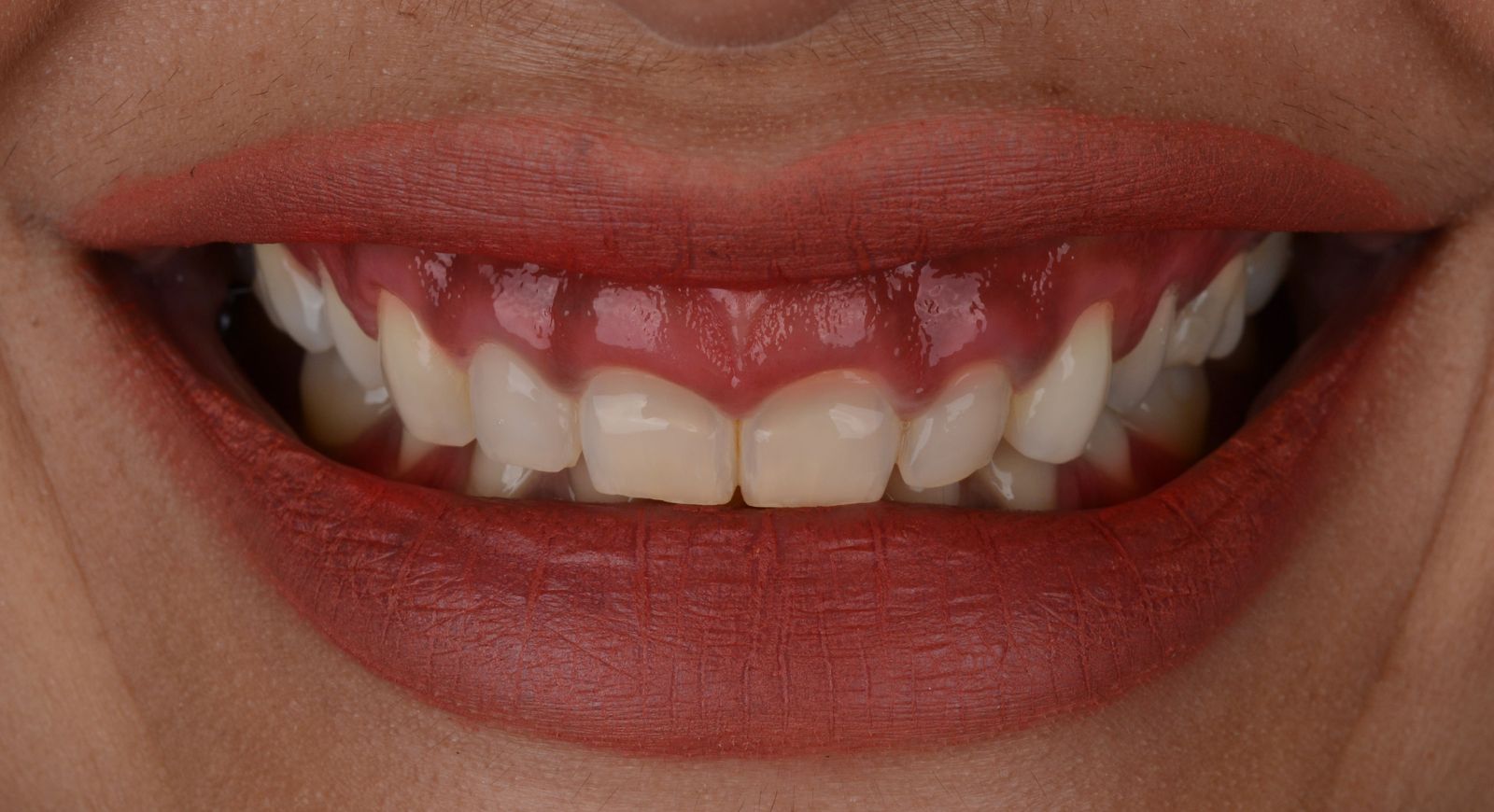 Close-up of a person's mouth