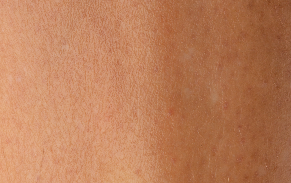 Close-up of human skin texture