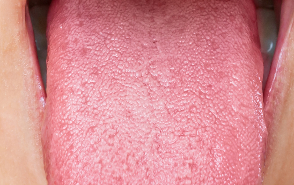 Close-up of a pink tongue with visible texture
