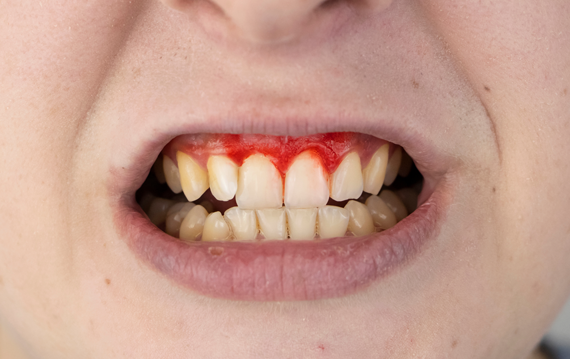 Toothpaste Alternative