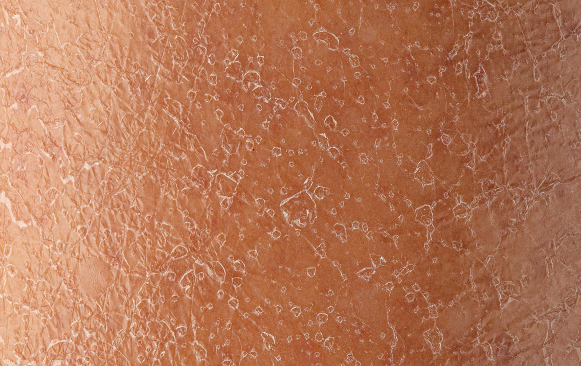 Close-up of human skin texture