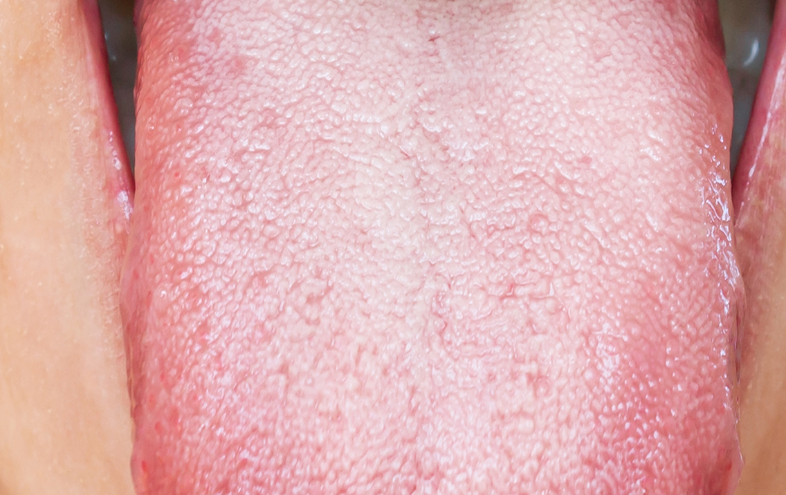 Close-up of a textured pink surface