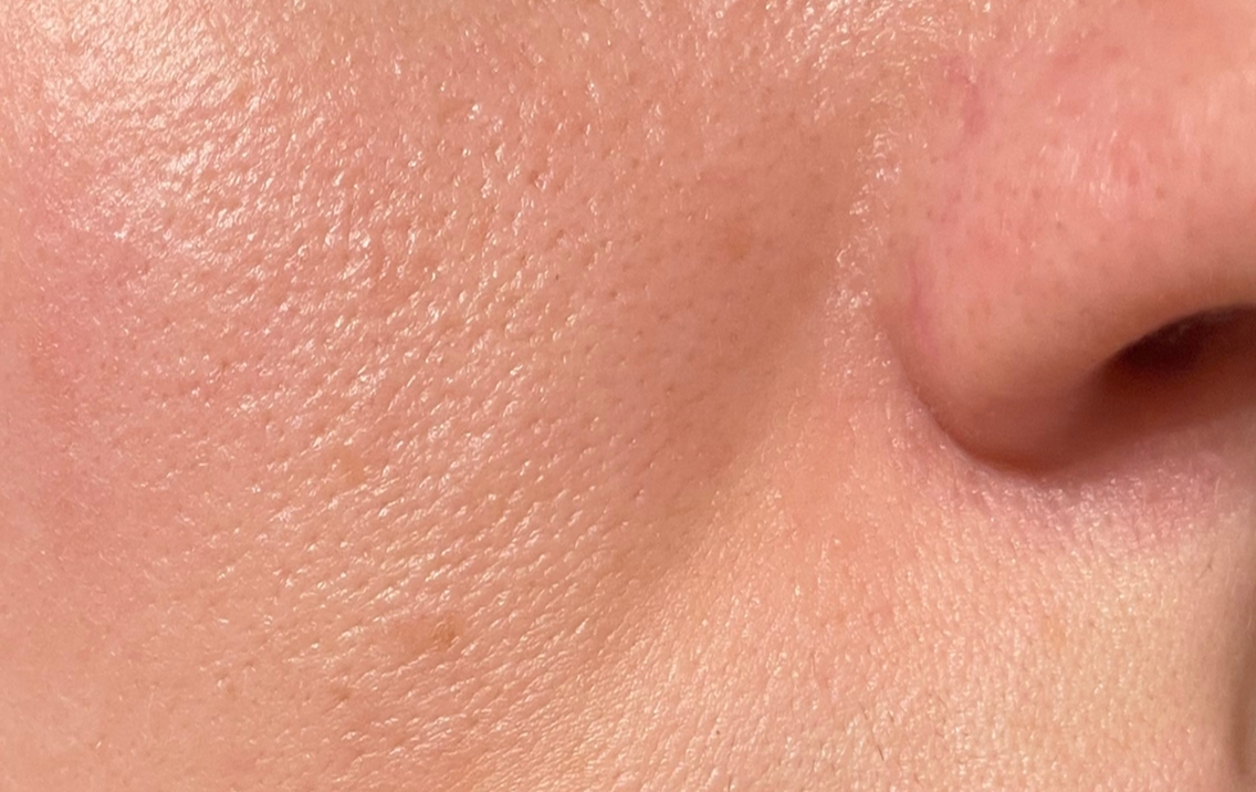 Close-up of a person's skin with a focus on texture and color.