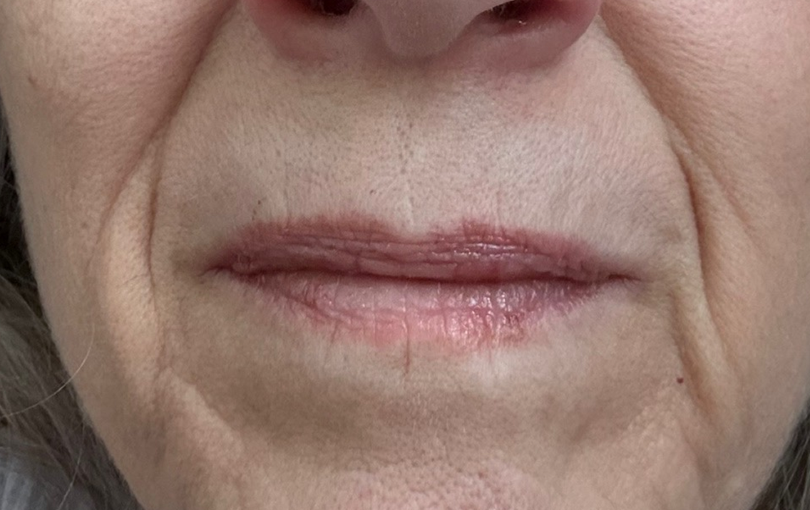 Close-up of a person's lips with visible aging skin texture.