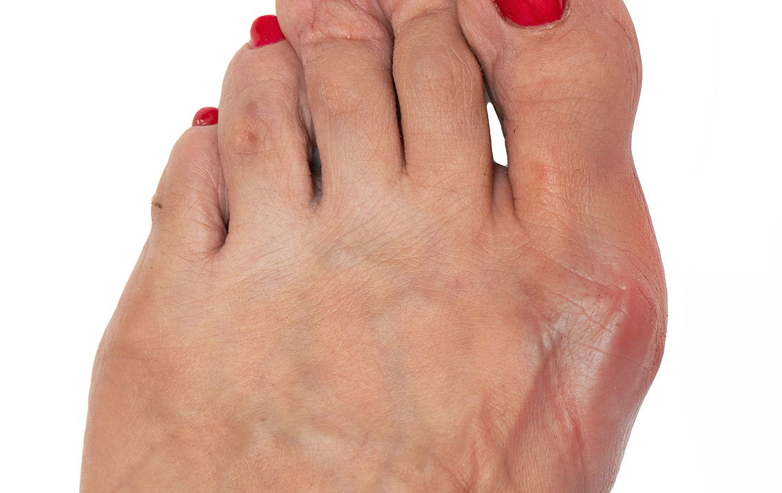 Close-up of a foot with red nail polish on toes against a white background
