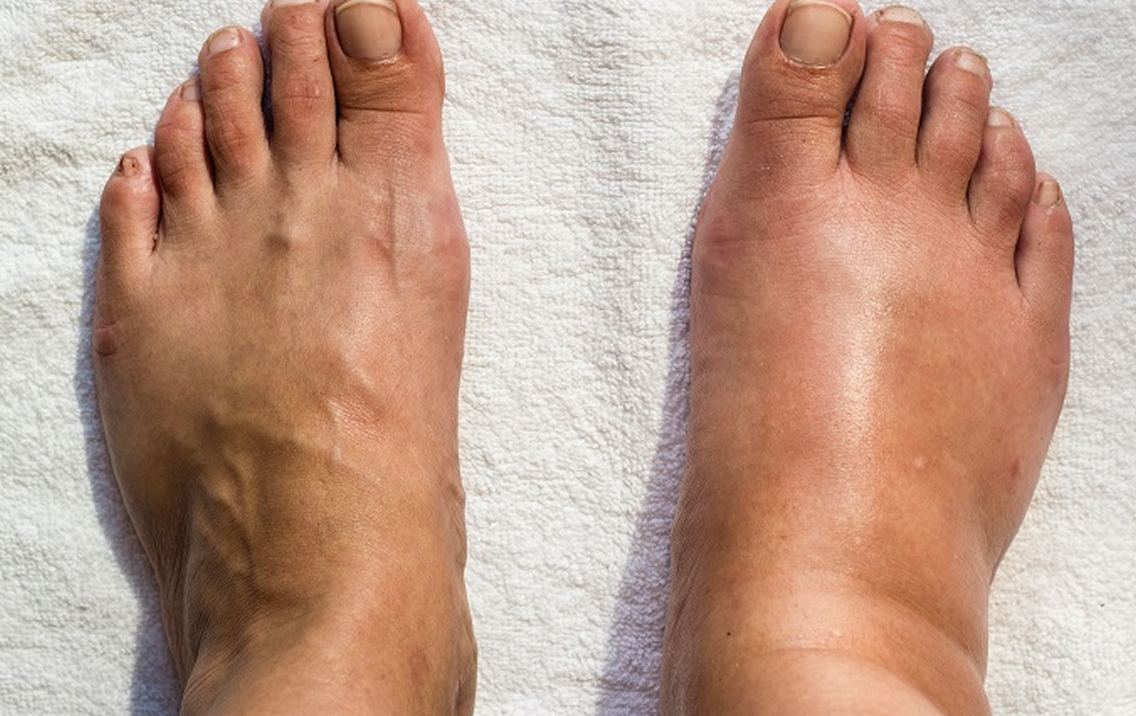 Two feet on a white towel