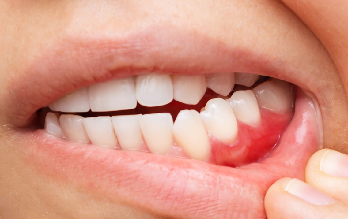 Toothpaste Alternative